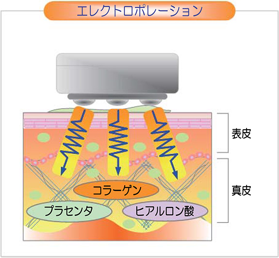 エレクトロポレーション